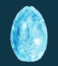 Silicone Tray - Alien Egg 4